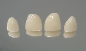 dente_zirconia_porcelana implante de zircônia