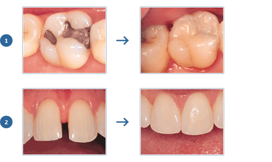 estetica_dental