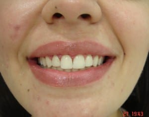 estetica_dental_2