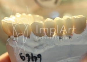 reabilitacao_oral