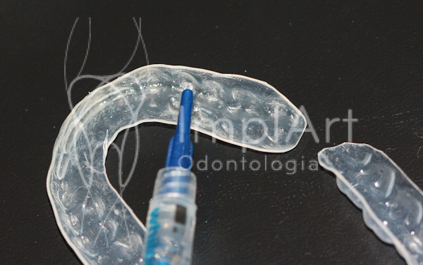 clareamento dental - gel clareador sendo aplicado sobre moldeira8555876482193593579