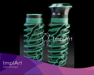 57f975fc Clínica de Implante Dentário e Prótese Dentária ImplArt